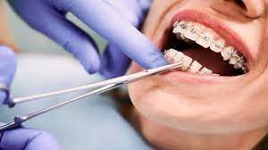 orthodonti