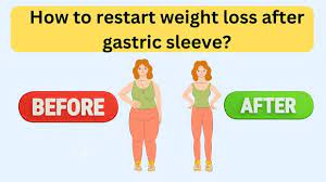 How To Restart Weight Loss After Gastric Sleeve