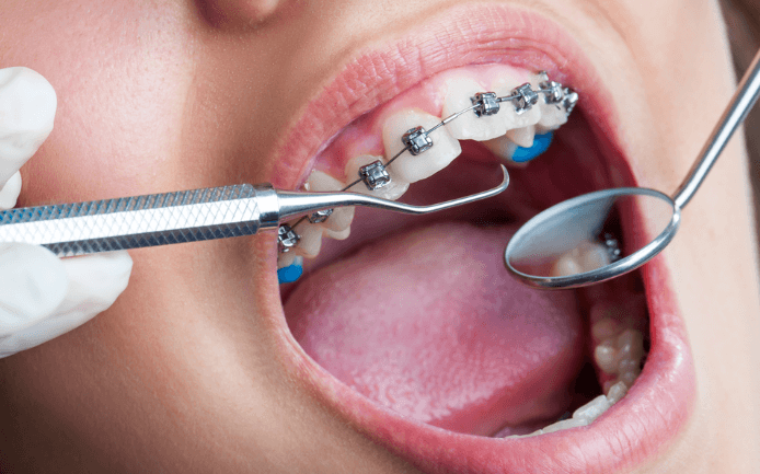 Orthodontic Care