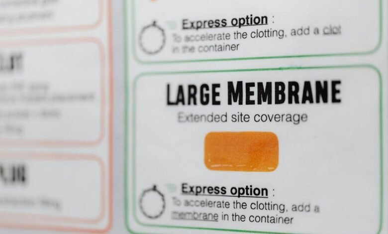 fhogis930 5z details uncovered